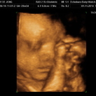 mason 28 weken zwanger 