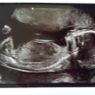Onze zoon! 
