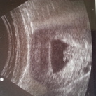 echo 8 wkn 