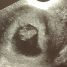  8 wk en 1 dag