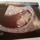 9 weekjes 