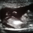 Ons nieuwe wondertje ^_^  