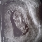  10 weken en 4 dagen..
Wauw wat bijzonder weer.:)