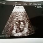 1e echo 7-1-2016 