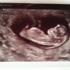 Baby2 10w6d