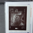 eerste echo  Alles goed en het hartje klop! <3