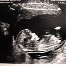  12,5 week ver!