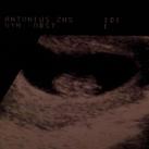 echo 9w2d 