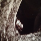  6 w en 4 dagen geschat <3 hartje klopt goed :) 