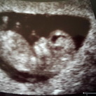 echo 10wk en 5dgn 