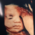  30w5d