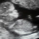  Echo 11,6 wkn