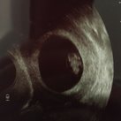 Echo 1 8 wk 