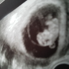 Ons lief klein wondertje 