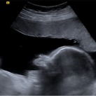 26w 2d 