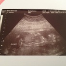 17 weken Echo van de geslachtsbepaling. It's a boy :-) !!