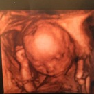 Its a girl We zijn zo blij alles was goed met onze kleindochter  