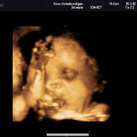 3d echo 