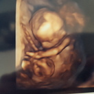  geslachtsecho It's a boy!