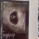 echo 25-08-2017 Het hartje klopt!! 6 weken en 2 dagen ongeveer.