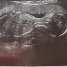  22weken , onze jongen weegt 470 gram en is ongeveer al 25 cm groot!