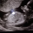  Heb afgelopen dinsdag echo gehad.kreeg deze foto's ze kon helaas niet zien wat het was beentjes zaten ervoor..misschien kunnen jullie het zien...

Kreeg ook deze schattige echo van een voetje van 1 cm