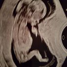 Echo 11 wk 