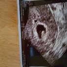 6w 3d 