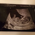 11 weken baby #2 