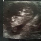 10+1 wk 