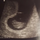 Eerste echo 