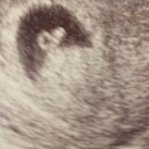 Eerste echo bij 6w3d 9-2-2018: Alles zag er goed uit en er was zelfs al een knipperende pixel, het hartje klopt <3 Over 2 weken de volgende echo. 
