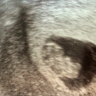 2e echo bij 8w3d Sterk kloppend hartje en bijna 2 cm <3 