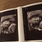 20wk 3D  