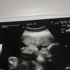 Baby 28 weken oud Onze zoon sabbelt aan zijn grote teen