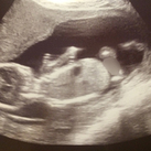 Echo bij 15w3d We hebben een echo gekregen tijdens de intake bij de verloskundige <3 Druk aan het bewegen, maar zij/hij bleef weggedraaid.
Aangezien we niet willen weten wat het wordt, en sommige meiden hier daar nogal een scherp oog voor hebben die sectie maar even onduidelijk gemaakt ;)