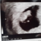 6wk +4d