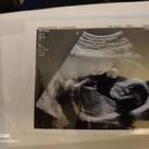 Babyboy 17 weekjes 