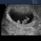 7w 3D 