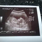 14wkn zwanger Een druk beweeglijk kindje met lange armpjes en beentjes. 
Ze konden je al niet meer goed opmeten omdat je al langer bent als 8,3cm en voortdurend aan het op en neer bewegen bent. 
Wat houden we nu al van je (L) 