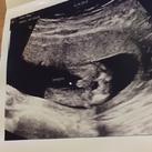  It's a boy <3 
11-1-2019 15+2 weken <3