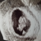 8w6d 