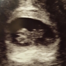 8w6d ♡♡♡