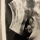 Baby nr 4  