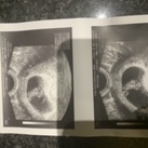 Meet our baby  