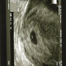 ons 2de kindje  5weken 6dagen oud ons kleine schat