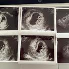 zwanger <3  4 foto's aan de linkerkant zijn van de echo van afgelopen maandag 24-05-2021
2 foto's aan de rechterkant zijn van de spoed echo op 15-05-2021