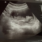 Nub foto Jongen of meisje?
