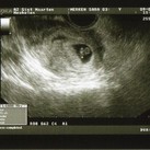 ons 2de kindje  6weken 6dagen oud