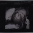  het eerste 4d fototje van ons kleine meisje op 24weken zwangerschap
